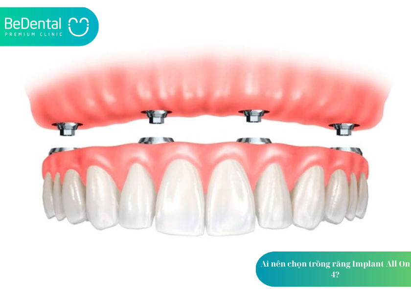 How much does teeth whitening cost 14 3
