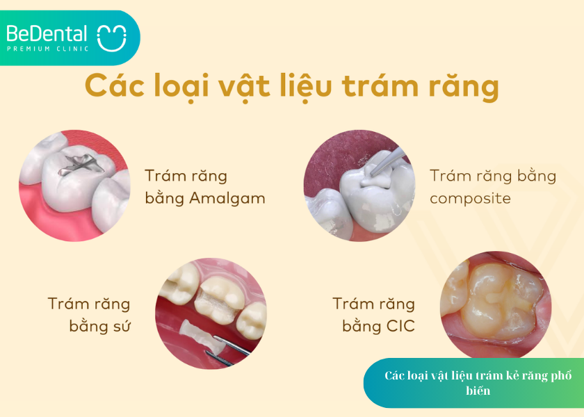 How much does teeth whitening cost 14 4