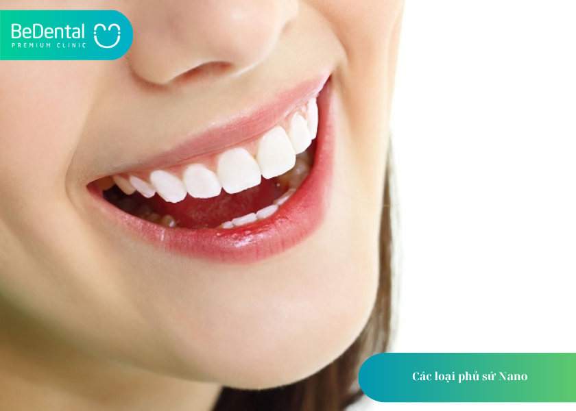 Phủ Sứ Nano: Giải Pháp Thẩm Mỹ Nha Khoa Hiện Đại Cho Nụ Cười Tự Tin 3 How much does teeth whitening cost 16