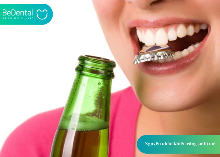 Răng Sứ Bị Mẻ: Nguyên Nhân, 4 Cách Xử Lý và Phòng Ngừa Hiệu Quả 2 Nguyên nhân khiến răng sứ bị mẻ