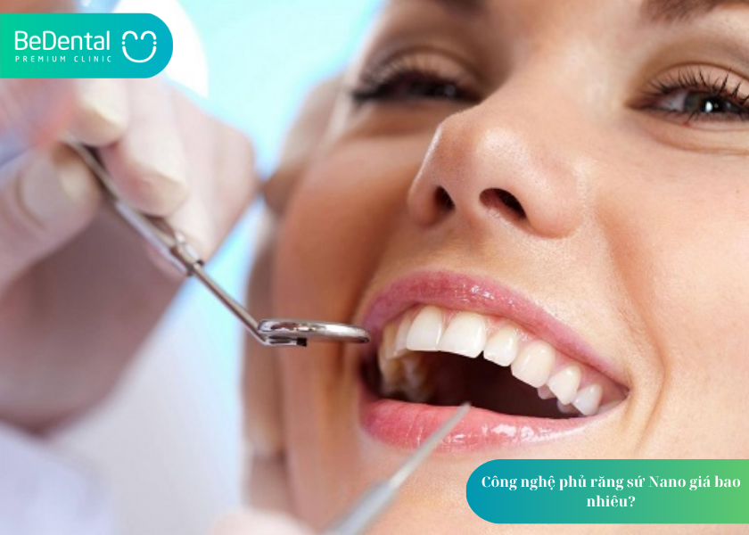 Phủ Sứ Nano: Giải Pháp Thẩm Mỹ Nha Khoa Hiện Đại Cho Nụ Cười Tự Tin 4 How much does teeth whitening cost 17
