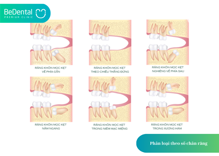 Cấu Tạo Của Răng Khôn: 4 Điều Bạn Cần Biết 5 How much does teeth whitening cost 19 2