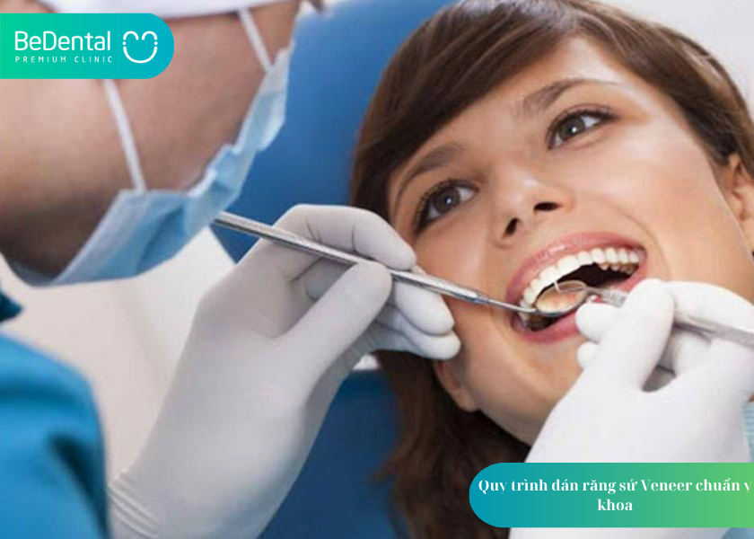Quy trình dán sứ Veneer: Bí quyết sở hữu nụ cười hoàn hảo không xâm lấn 2 How much does teeth whitening cost 2 4