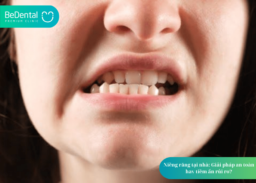 How much does teeth whitening cost 2 min 10
