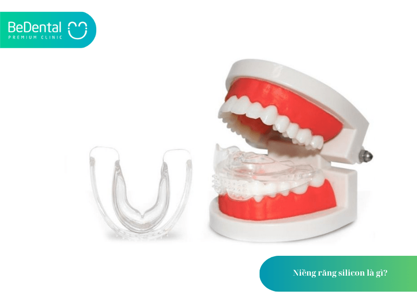 Niềng răng silicon và 4 điều bạn cần biết 2 How much does teeth whitening cost 2 min 7