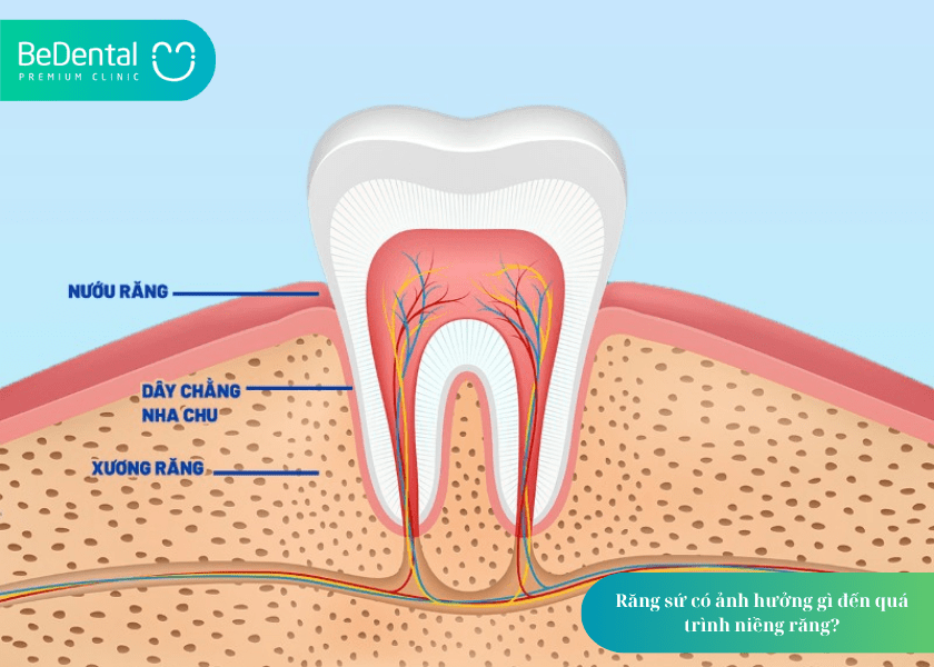 Răng sứ có niềng được không? Giải đáp chi tiết từ chuyên gia nha khoa 2 How much does teeth whitening cost 2 min 8