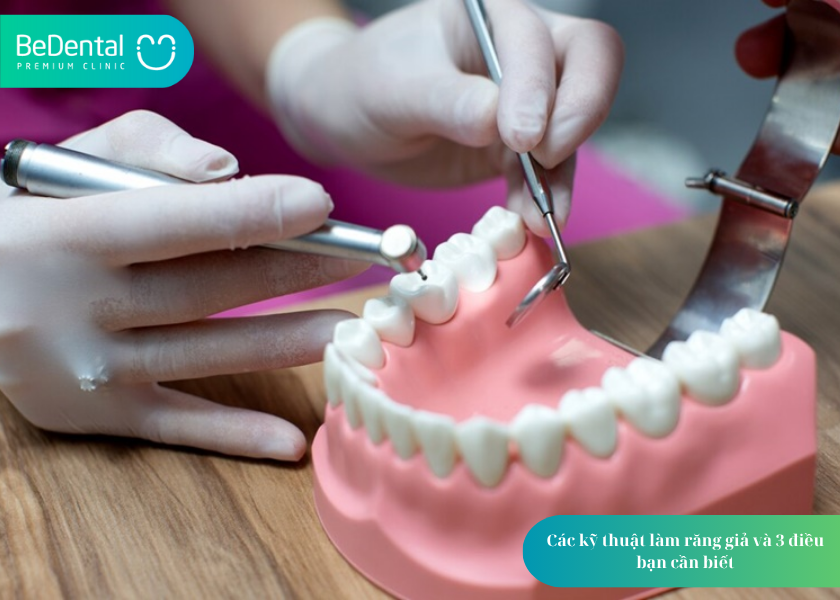 Các kỹ thuật làm răng giả