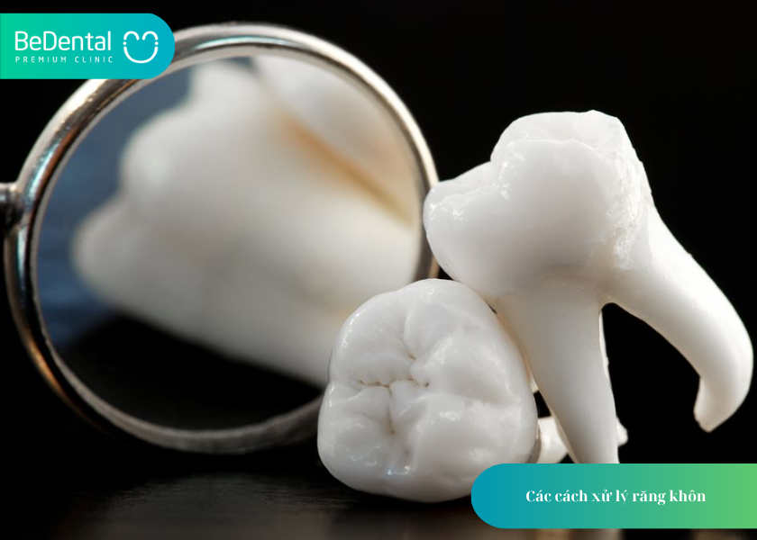 Cấu Tạo Của Răng Khôn: 4 Điều Bạn Cần Biết 6 How much does teeth whitening cost 20 3