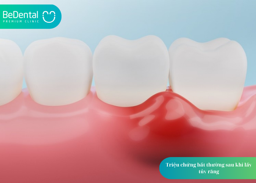 How much does teeth whitening cost 23 4
