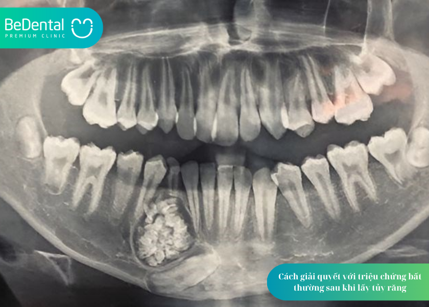 How much does teeth whitening cost 25 4