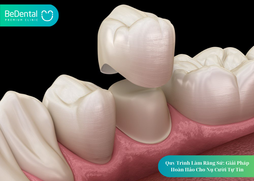 How much does teeth whitening cost 26 2