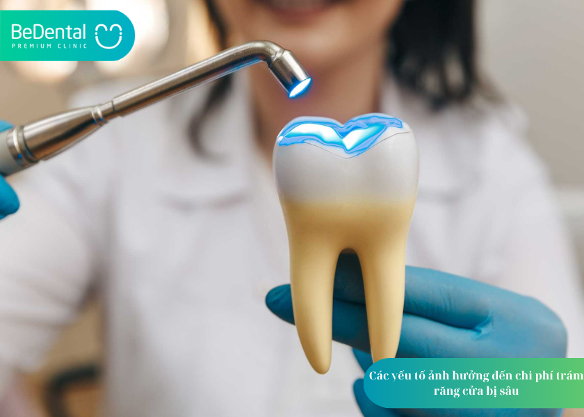 How much does teeth whitening cost 29 2