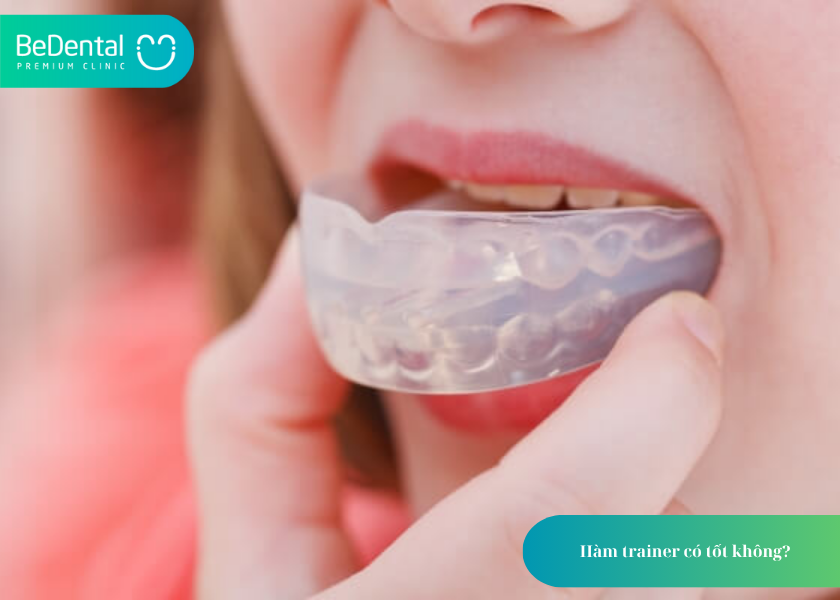 Hàm Trainer: Giải Pháp Định Hình Răng Hiệu Quả Cho Trẻ Em Và Người Lớn 3 How much does teeth whitening cost 3 1