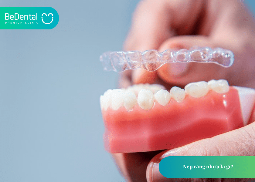 Nẹp răng nhựa và 4 điều cần biết 2 How much does teeth whitening cost 3 min 7