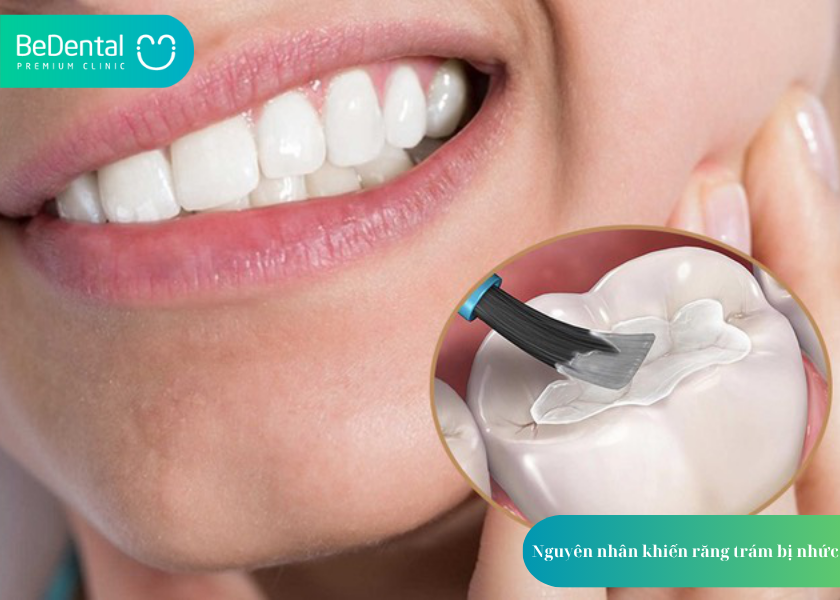How much does teeth whitening cost 33 1