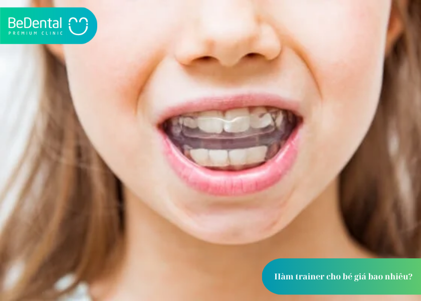 Hàm Trainer: Giải Pháp Định Hình Răng Hiệu Quả Cho Trẻ Em Và Người Lớn 4 How much does teeth whitening cost 4 1