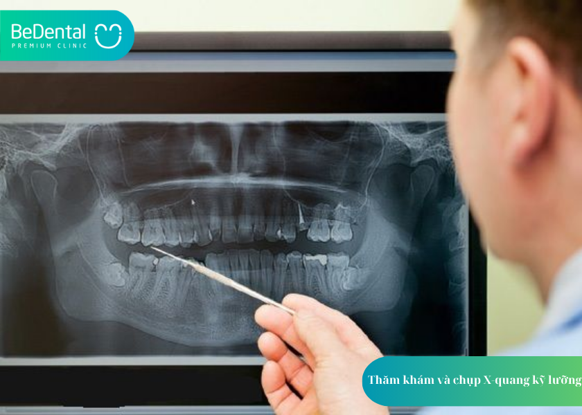 Răng Khôn Mọc Lệch Ra Má Hàm Trên: Tác Hại Và Cách Xử Lý 5 How much does teeth whitening cost 4 5