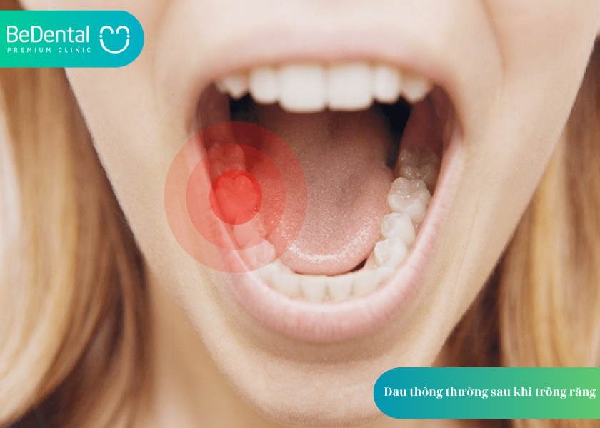 How much does teeth whitening cost 4 9