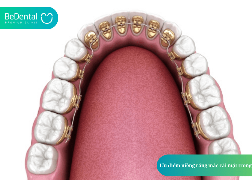 How much does teeth whitening cost 4 min 5