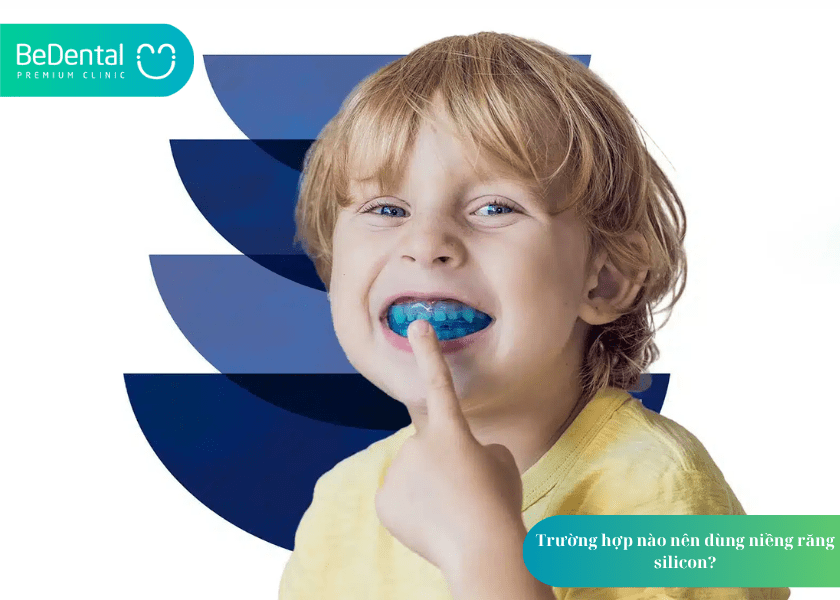 Niềng răng silicon và 4 điều bạn cần biết 4 How much does teeth whitening cost 4 min 8
