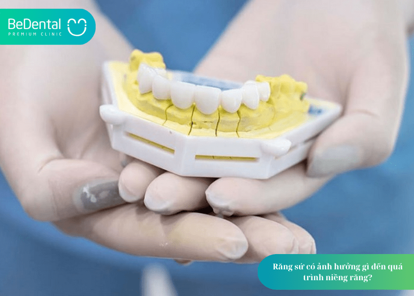Răng sứ có niềng được không? Giải đáp chi tiết từ chuyên gia nha khoa 4 How much does teeth whitening cost 4 min 9
