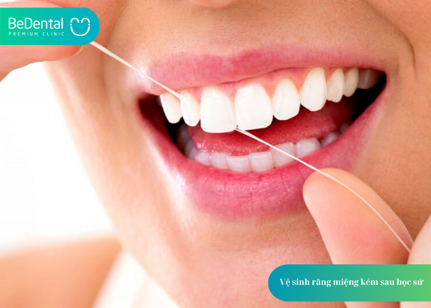 How much does teeth whitening cost 42