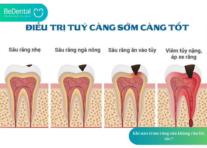 How much does teeth whitening cost 43 1