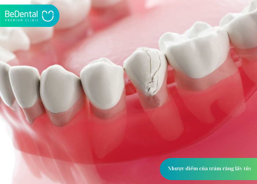 How much does teeth whitening cost 46 1