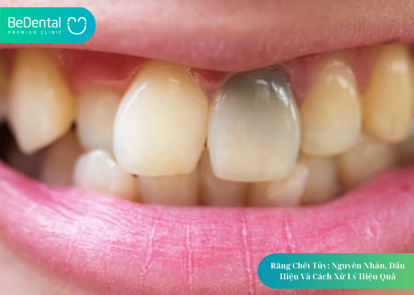 How much does teeth whitening cost 48