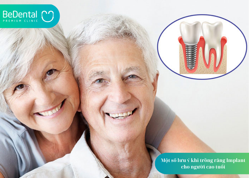 Trồng răng Implant cho người cao tuổi: Có nên không và cần lưu ý gì? 5 How much does teeth whitening cost 5 6