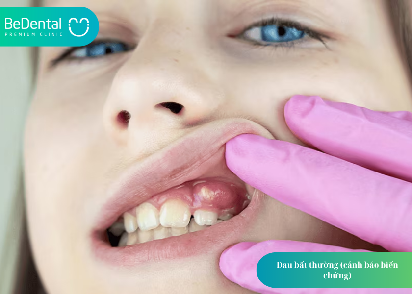 How much does teeth whitening cost 5 8