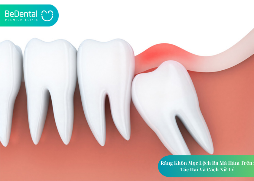 How much does teeth whitening cost 58