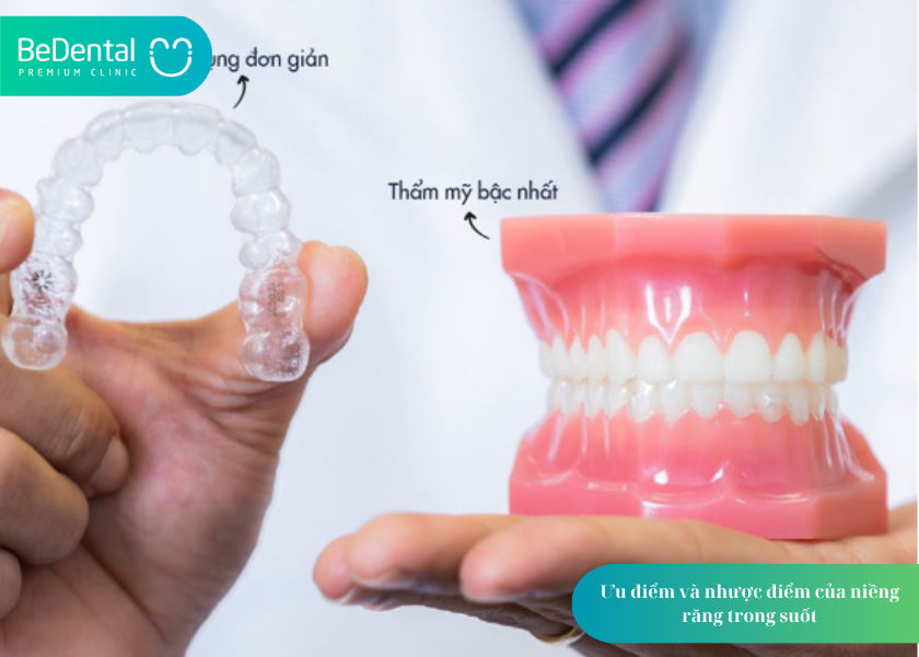 Niềng trong suốt và 4 điều cần biết 3 How much does teeth whitening cost 6