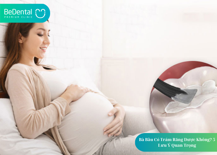 Mẹ bầu có trám răng được không?