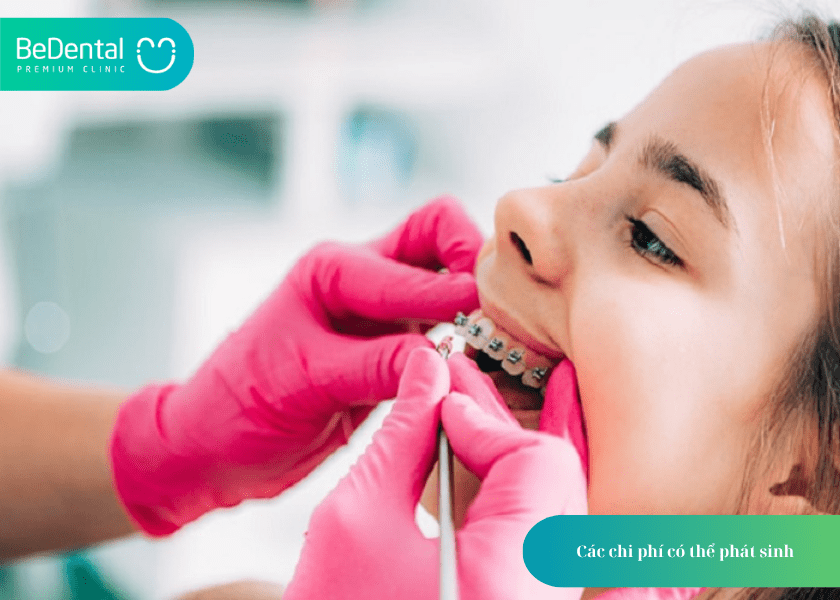 Niềng Răng Tháo Lắp Mức 1: Phương Pháp Chỉnh Nha Sớm Hiệu Quả Cho Trẻ Em 6 How much does teeth whitening cost 7 min 6