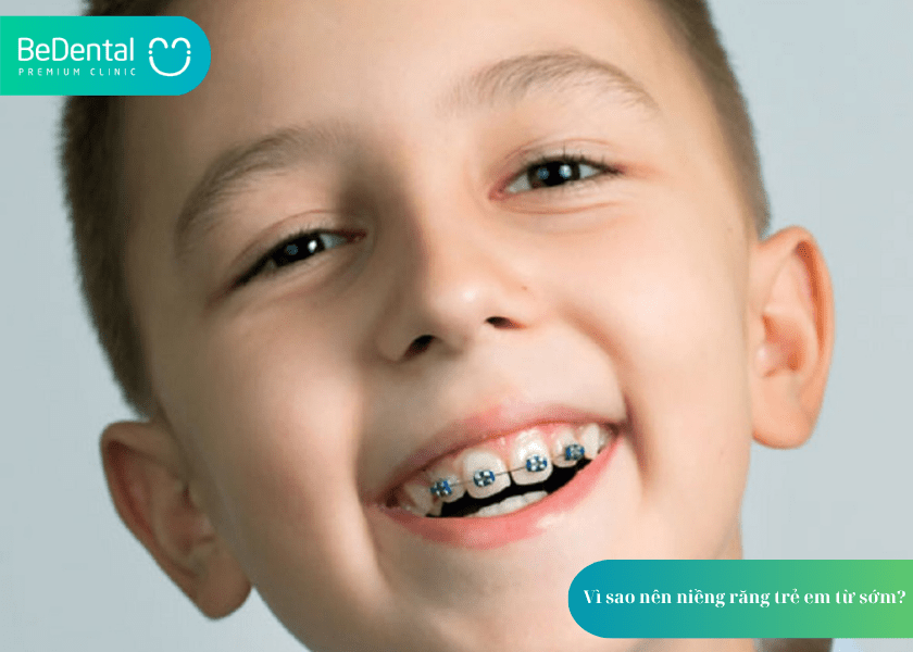 Niềng răng trẻ em và 5 sai lầm phụ huynh thường gặp khi chọn phương pháp niềng răng cho con 2 How much does teeth whitening cost 7 min 9