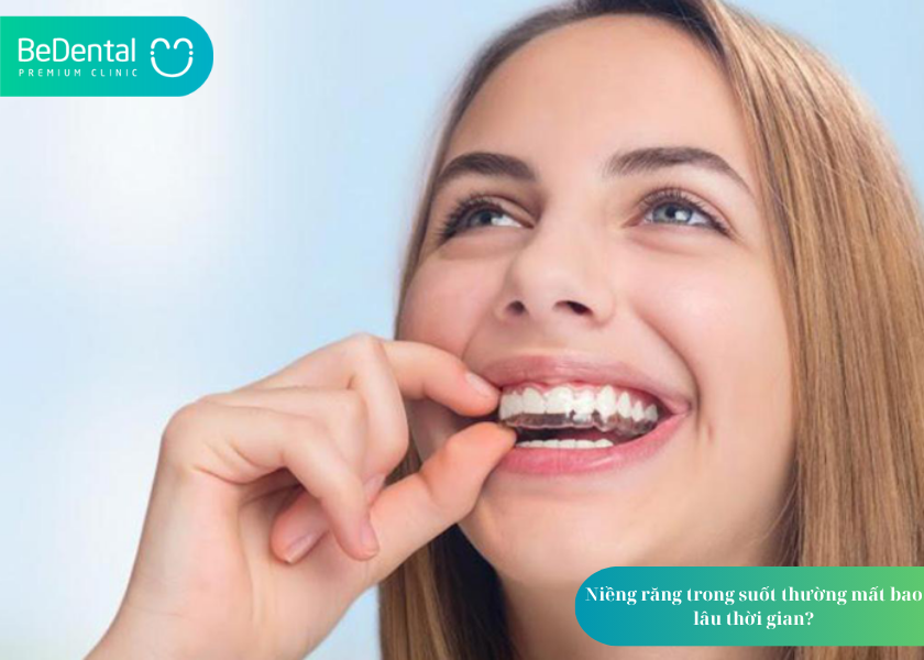 Niềng trong suốt và 4 điều cần biết 4 How much does teeth whitening cost 7