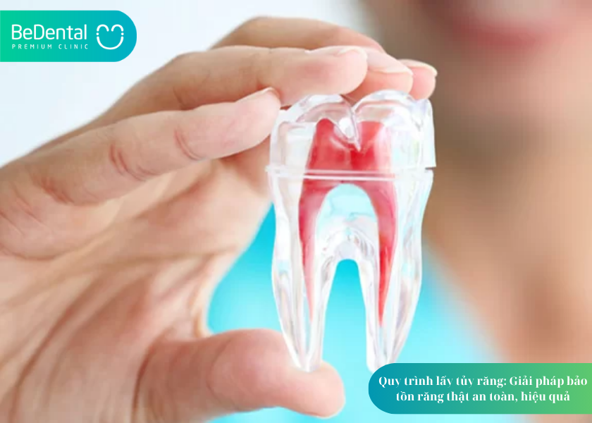Quy trình lấy tủy răng chuẩn y khoa