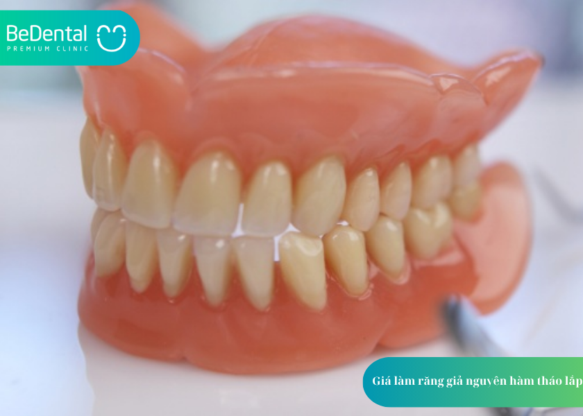 GIÁ LÀM RĂNG GIẢ NGUYÊN HÀM: 3 THÔNG TIN CHI TIẾT CHO NGƯỜI MẤT RĂNG TOÀN HÀM 2 Giá làm răng giả nguyên hàm