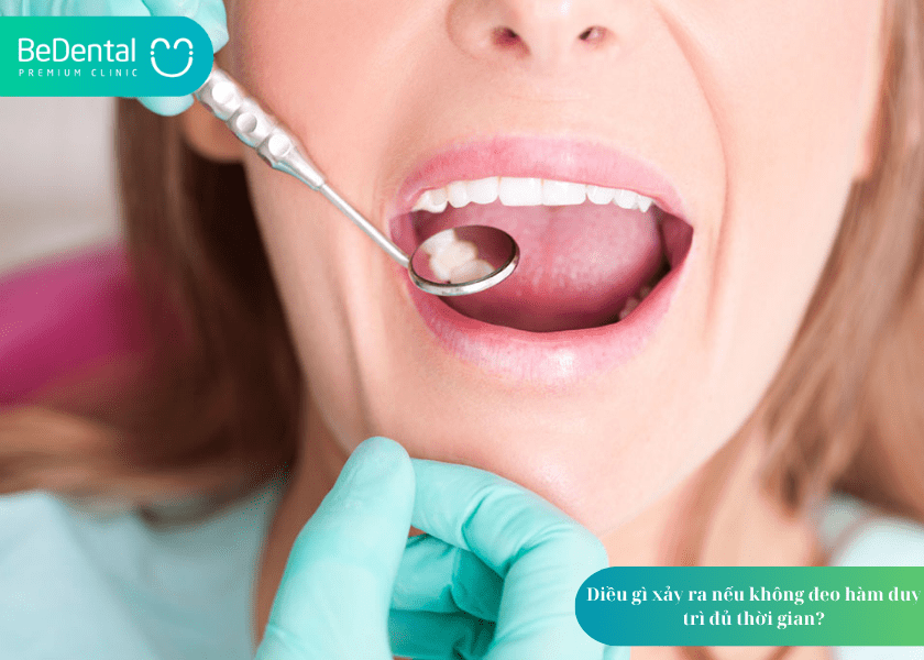 Đeo hàm duy trì trong bao lâu? Giải đáp chi tiết từ chuyên gia chỉnh nha 7 How much does teeth whitening cost 8 min 7