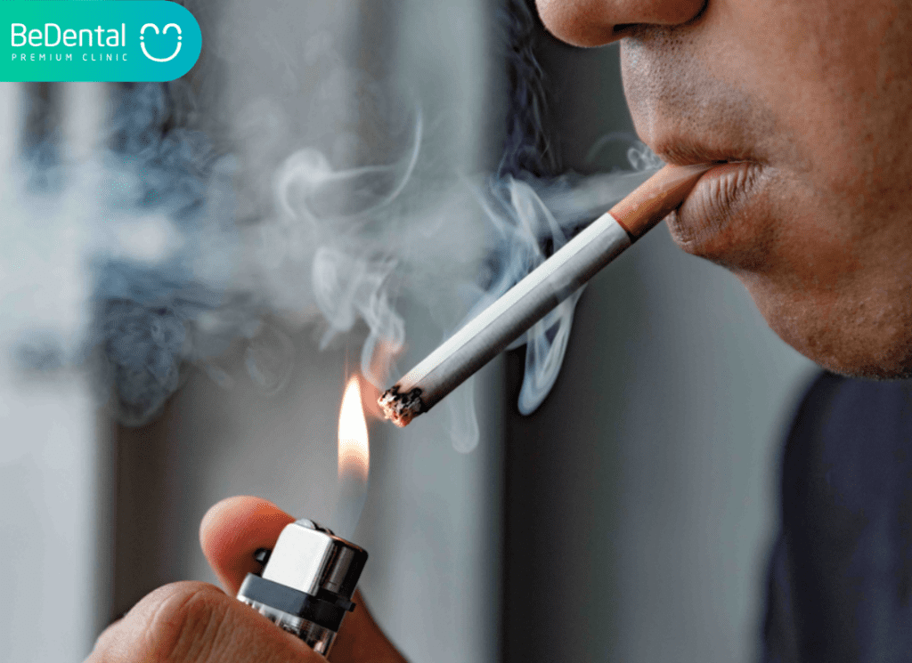 Bị Hôi Miệng Là Bệnh Gì? Nguyên Nhân, Triệu Chứng Và Giải Pháp Điều Trị Hiệu Quả 4 Hut thuoc la
