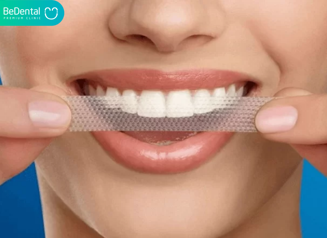 Giá đèn tẩy trắng răng. Giá đèn tẩy trắng răng. Giá đèn tẩy trắng răng