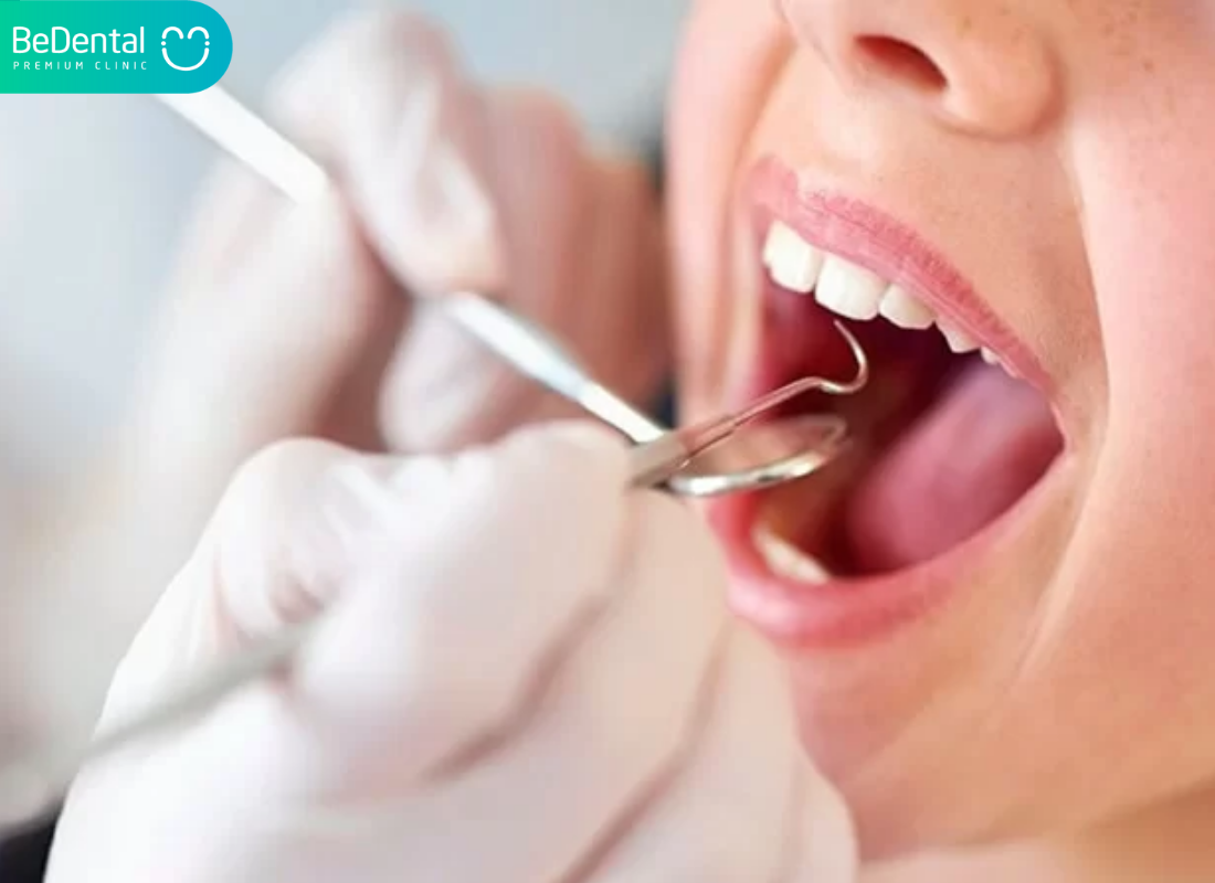 Cách chăm sóc răng miệng đúng cách