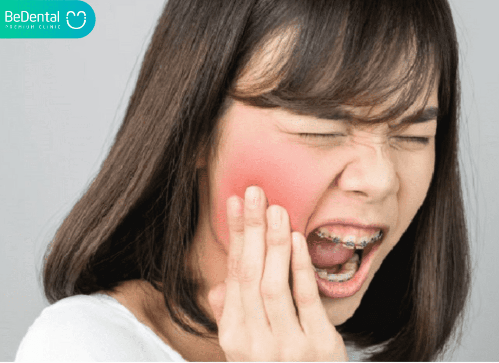 nhức răng kinh khủng