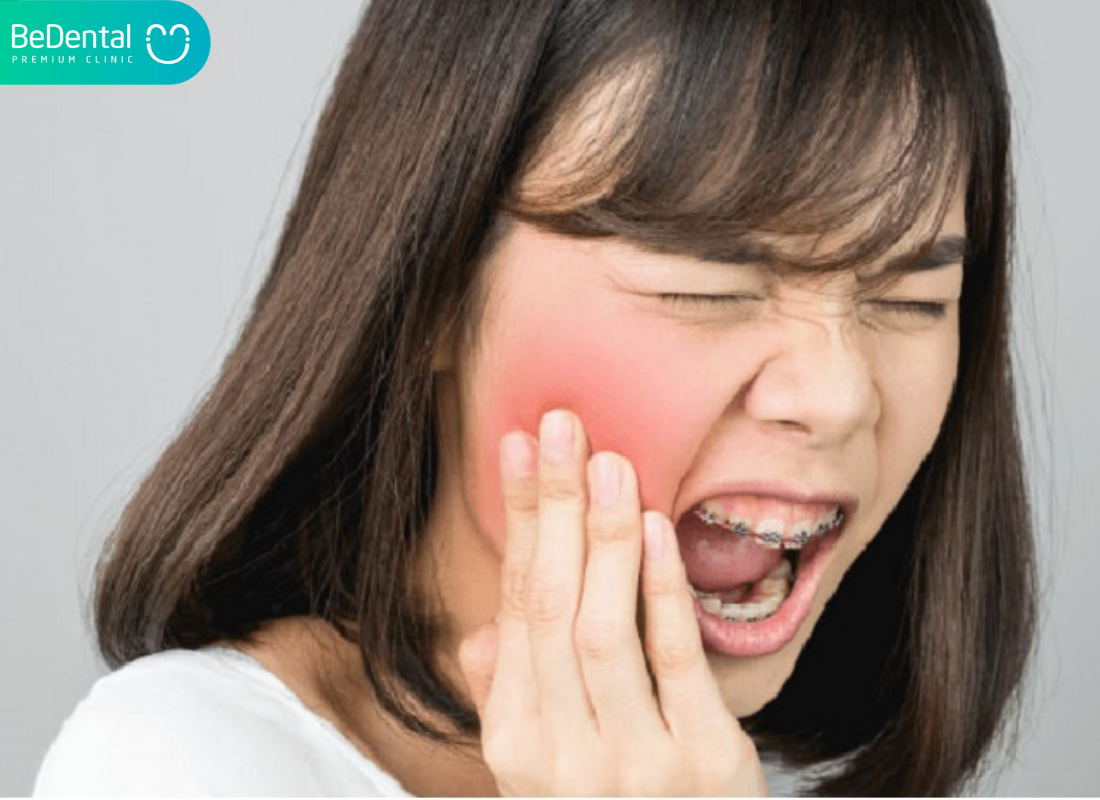 nhức răng kinh khủng