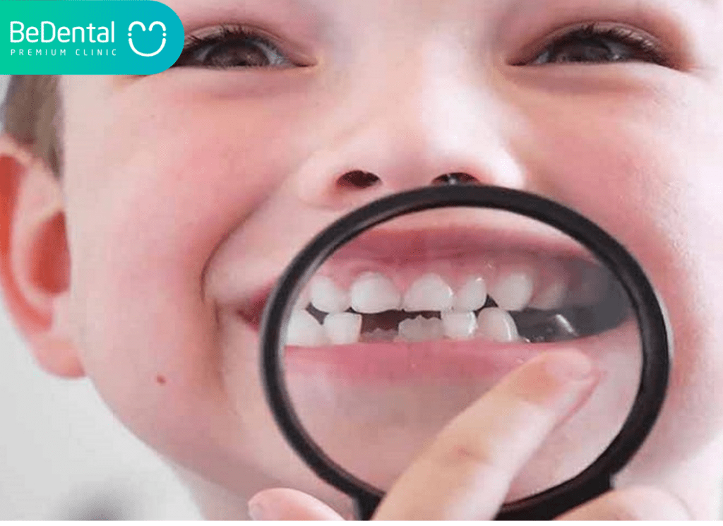 Giải đáp thắc mắc: Có nên bọc răng sứ không các mẹ? 3 Rang vinh vien cua tre chua phat trien