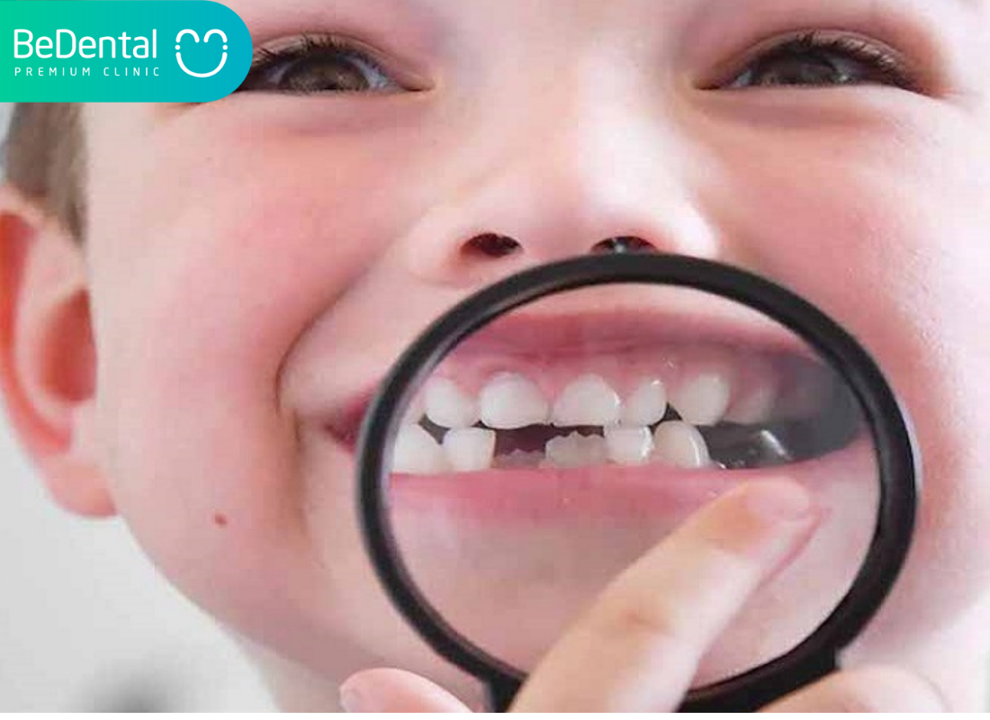 Lịch thay răng sữa 4 Lịch thay răng sữa