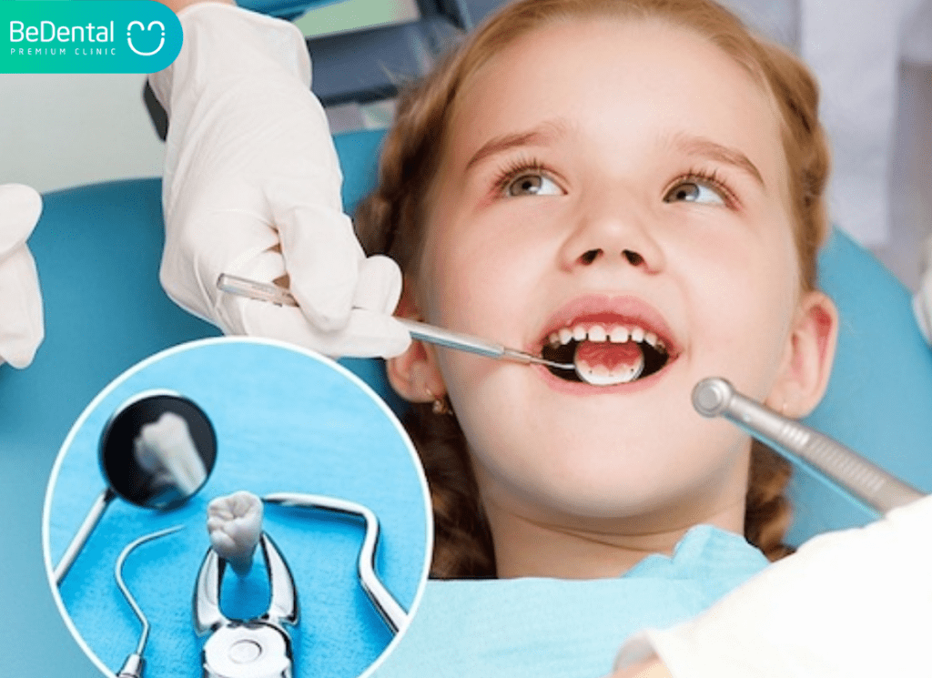 cách nhổ răng tại nhà không đau cho trẻ