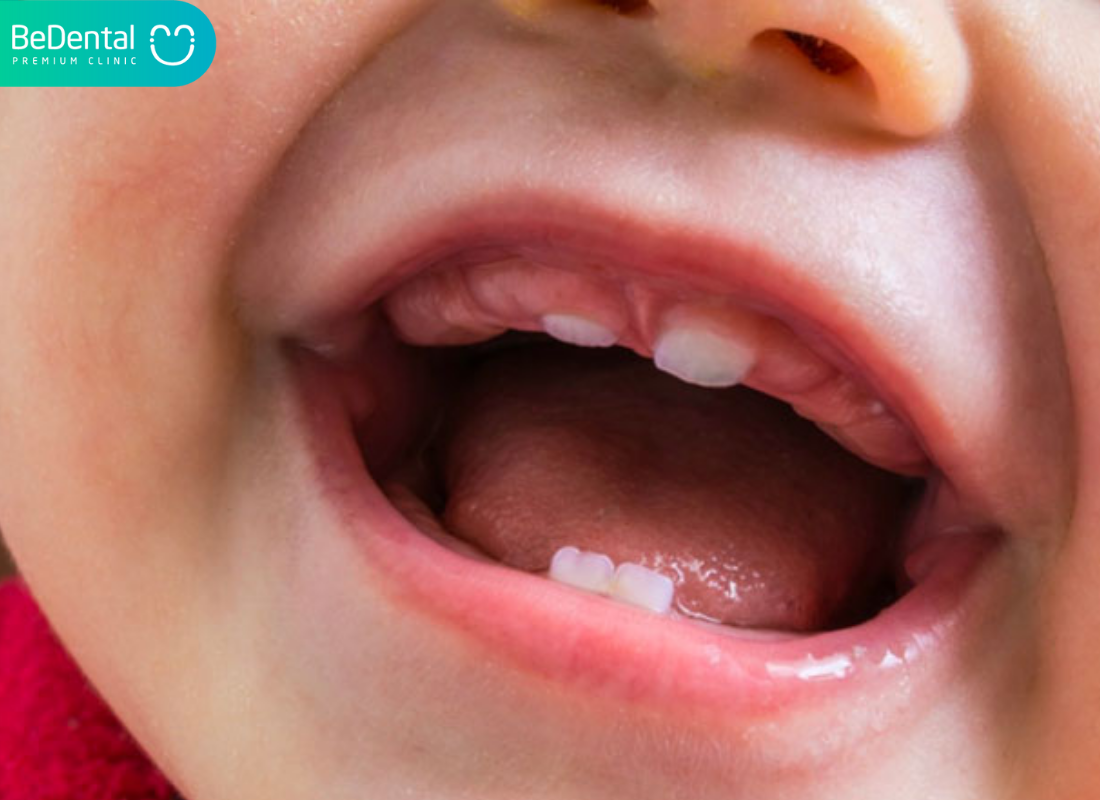 Cách làm cho răng mọc nhanh nhất
