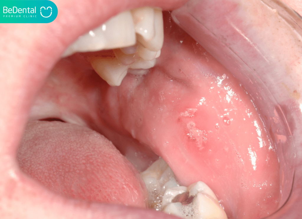 Niêm mạc miệng là gì? Nguyên nhân,dấu hiệu nhận biết và cách điều trị 3 Chuc nang cua niem mac mieng